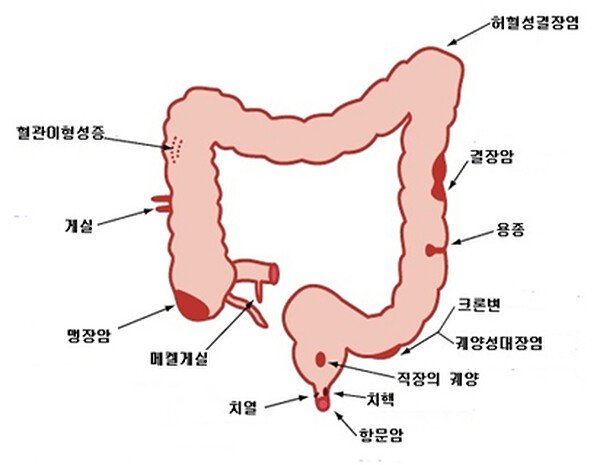 대장의 구조 — 상행결장, 횡행결장, 하행결장, 에스결장, 직장
