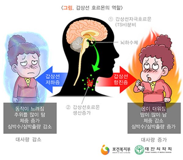갑상선 호르몬의 역할 — 호르몬이 부족할 때와 과다할 때 몸의 변화